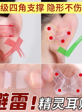 蝴蝶型精灵耳贴耳朵支撑器大脸显小隐形真比更舒服防水无痛美容