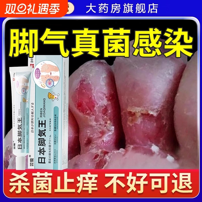 脚气臭脚痒出汗脚气喷雾止脱皮抑真菌脚泡脚丫根趾缝糜烂痒专用