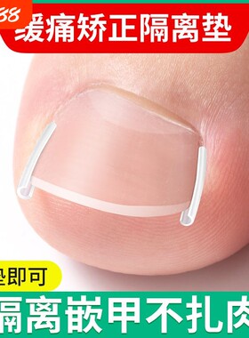 甲沟嵌甲矫正器矫正|千人加购