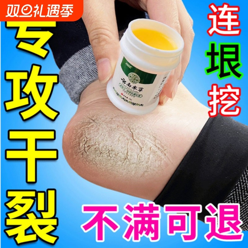 专治脚裂脚后跟干裂起硬皮足跟开裂真菌防皲裂脱皮修复霜药膏手足