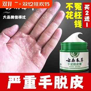 手足脱皮膏手指上起皮干燥爆皮儿童手掌蜕皮手心手脚掉皮褪头专用