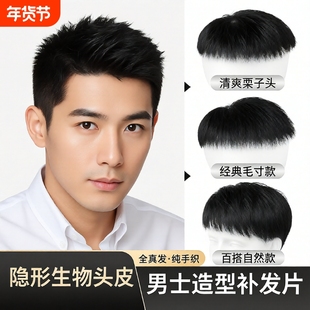 假发男短发寸头真发男士隐形头顶发片发际线神器前额补补发丝发型