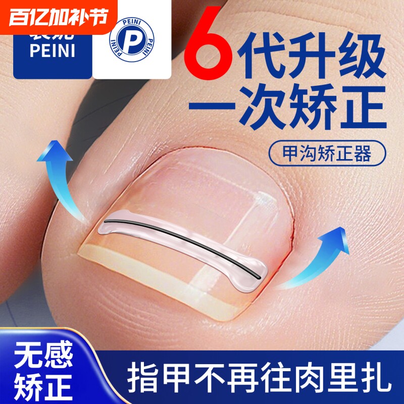 甲沟专用矫正器嵌纠贴片修剪脚趾卷指不再往肉里长炎刀钳成人工具