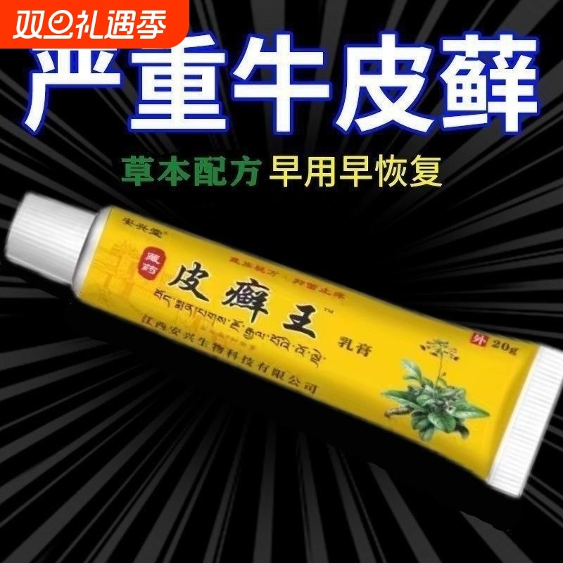 安兴堂藏药皮癣王乳膏20g皮肤外用抑菌软膏