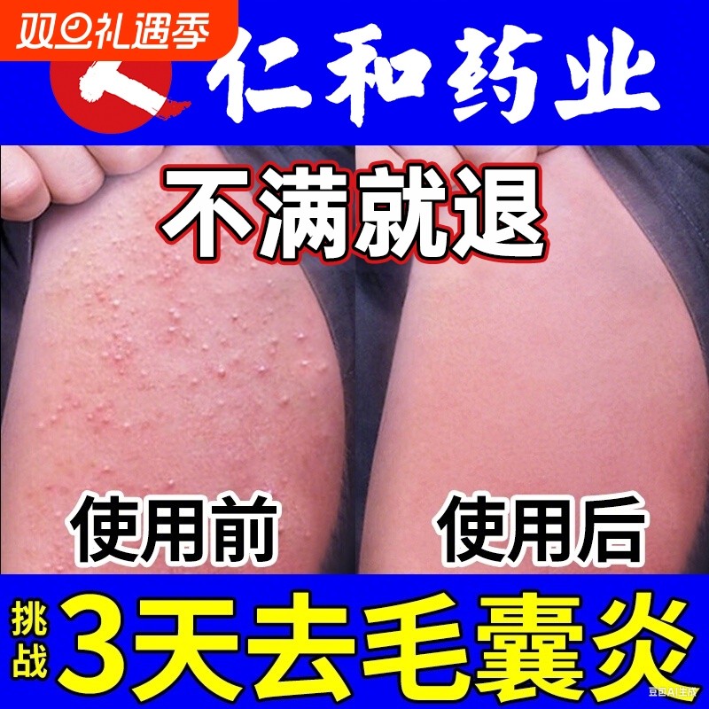 手臂毛囊炎专用长痘痘胳膊上的小疙瘩膏贴净鸡皮肤角化感染