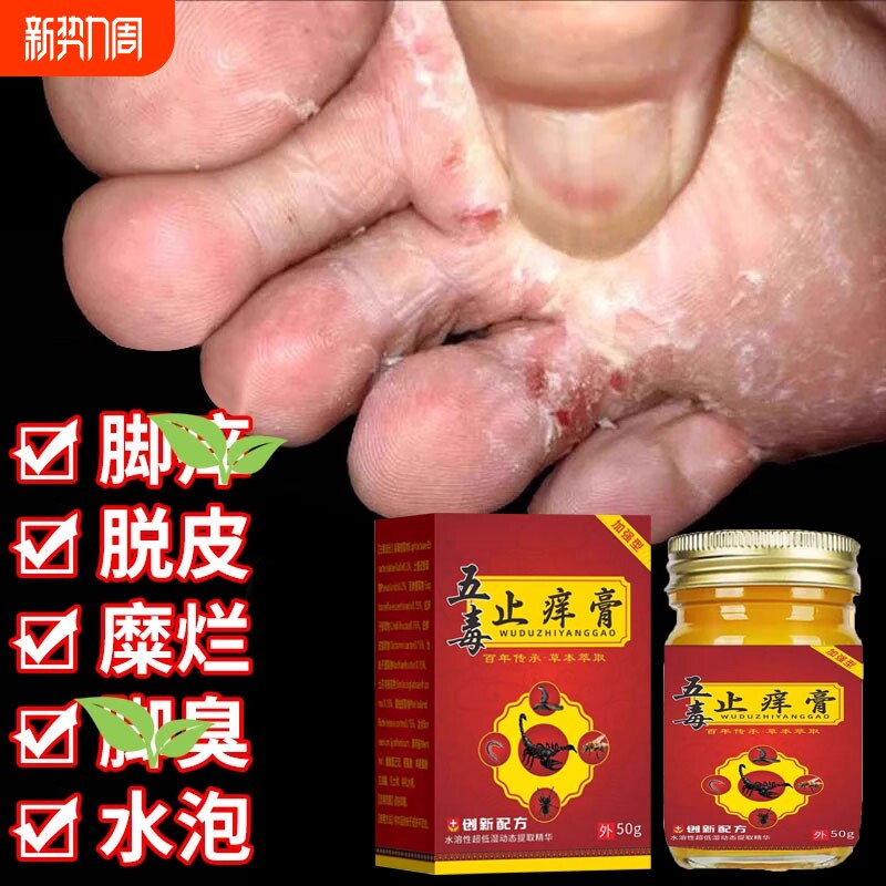 去脚臭克星脚痒脱皮真菌感染烂脚丫专用五毒止痒膏官方旗舰店正品