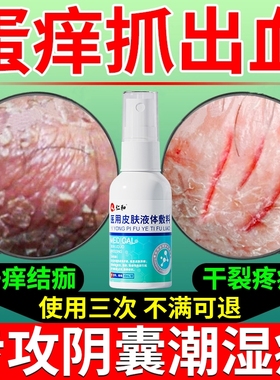 仁和阴囊湿疹瘙痒男性特效痒止睾丸私处真菌感染股藓大腿内侧人