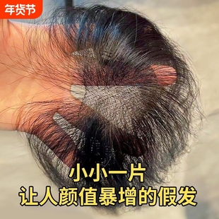 胎毛刘海假发女片头顶遮秃顶神器高颅顶蓬松真发无痕发际线假发贴