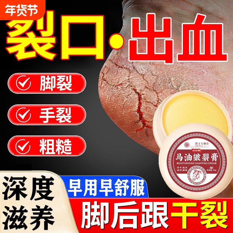 脚后跟干裂修复霜起硬皮足跟开裂手指头治裂口保湿修护皲裂复马油