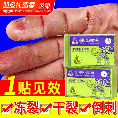 手脚干裂贴手足贴手指裂口专用胶布防裂皲裂贴脚后跟足部防水胶带