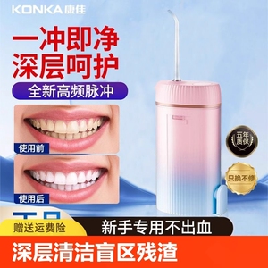 冲牙器家用便携式水牙线正畸专用洁牙齿缝电动洗牙神器超声波
