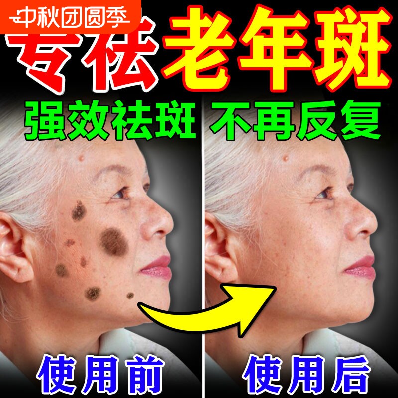 老年斑美白祛斑霜黄褐专用膏药强力去手部除脸部一擦就掉中老年人图片