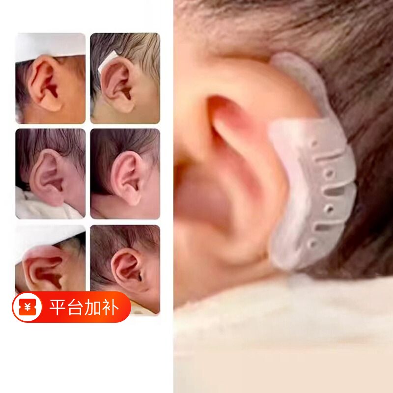 耳朵矫正器婴儿新生的儿耳贴外耳垂耳招风耳耳夹辅助定型器材耳撑