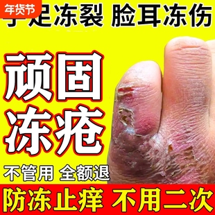 冻疮膏止痒冻伤膏正品排行榜第一名防足裂手指裂口干皴裂修复膏M