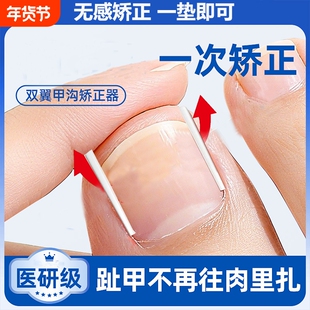 甲沟矫正神器炎指甲矫正器嵌甲正甲垫片脚趾甲往肉里长填充垫棉花