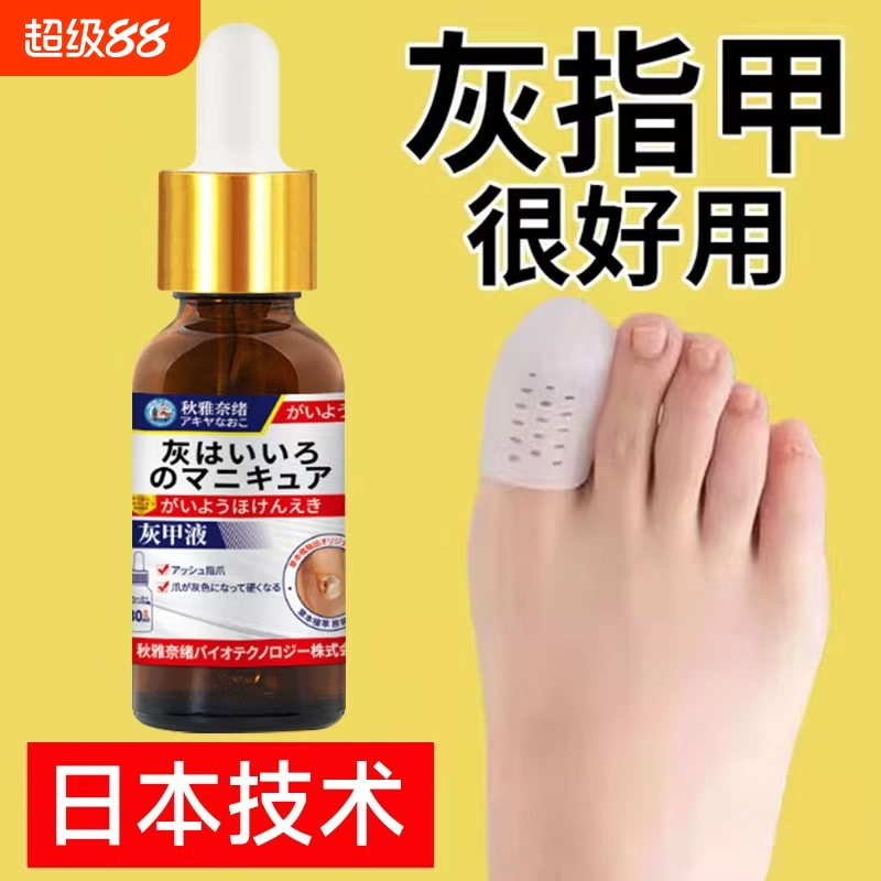 灰指甲专用抑菌液发黄增变厚变硬修剪刀冰醋酸涂剂趾膏正品旗舰店