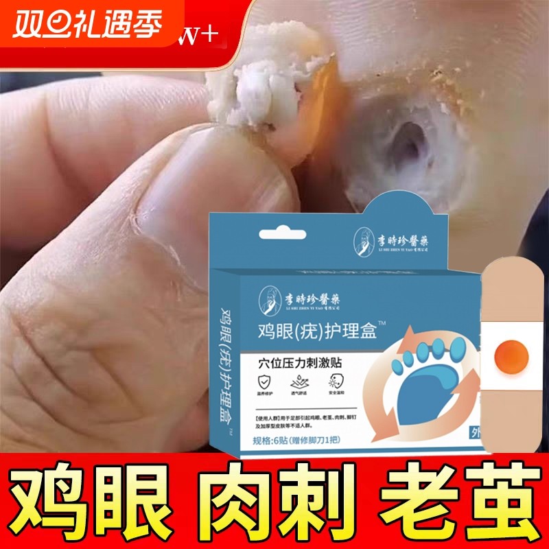 李时珍鸡眼贴鸡眼膏药水瘊子手足部去脚底脚趾部跖疣老茧根肉刺