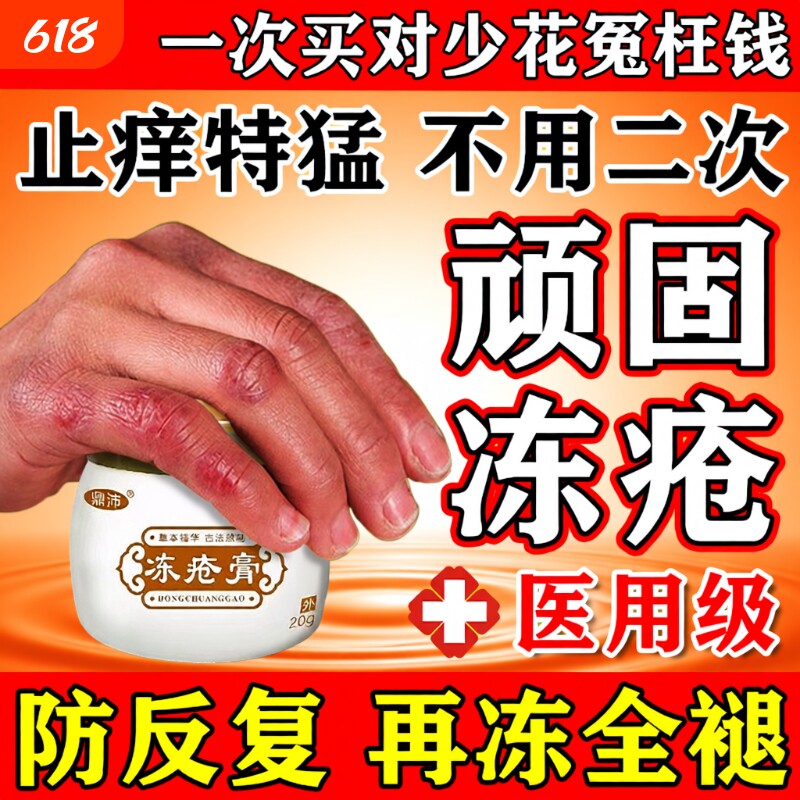 冻疮膏止痒冻伤膏正品排行榜第一名冬天防冻裂脸耳朵手足X药抑菌