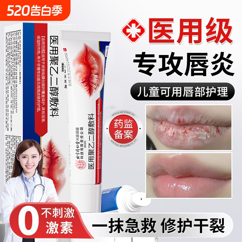 唇炎润唇膏嘴唇干裂脱皮唇膏保湿滋润去死皮口角炎医用修护膏专用