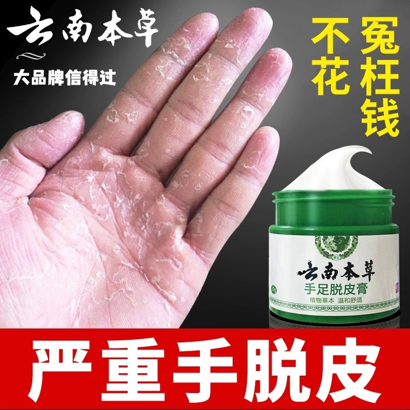 云南本草手足脱皮膏手指上起皮干燥儿童掉皮专用抑菌植物草本保湿