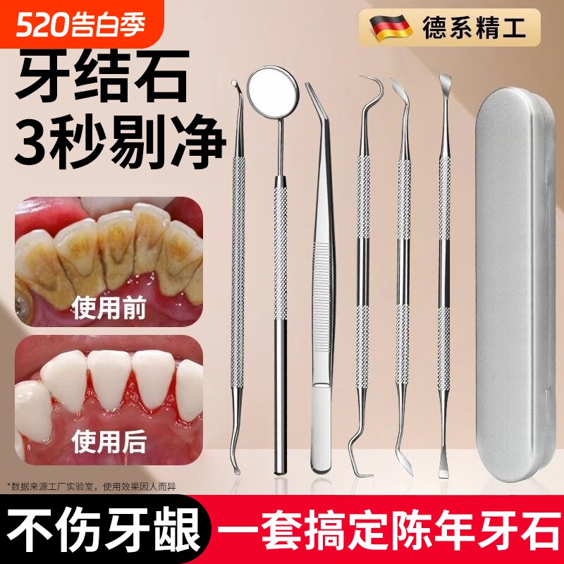 牙结石去除器牙齿清洁口腔镜子剔牙神器去污垢工具专用洁牙科家用