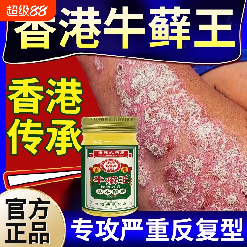 香港牛藓王止痒正品专用癣