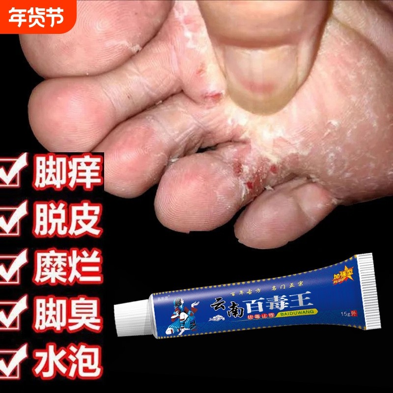 苗药百毒王药膏旗舰店抑菌奇草皮肤止痒膏脚丫子痒烂脚除臭水泡