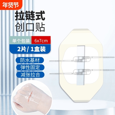 缝合pu材质减张器伤口减张