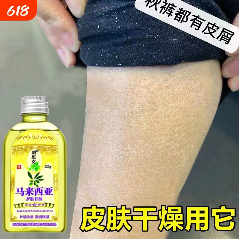 小腿干燥起皮鱼鳞皮肤霜秋冬皮肤干痒儿童护肤甘油身体润肤油止痒