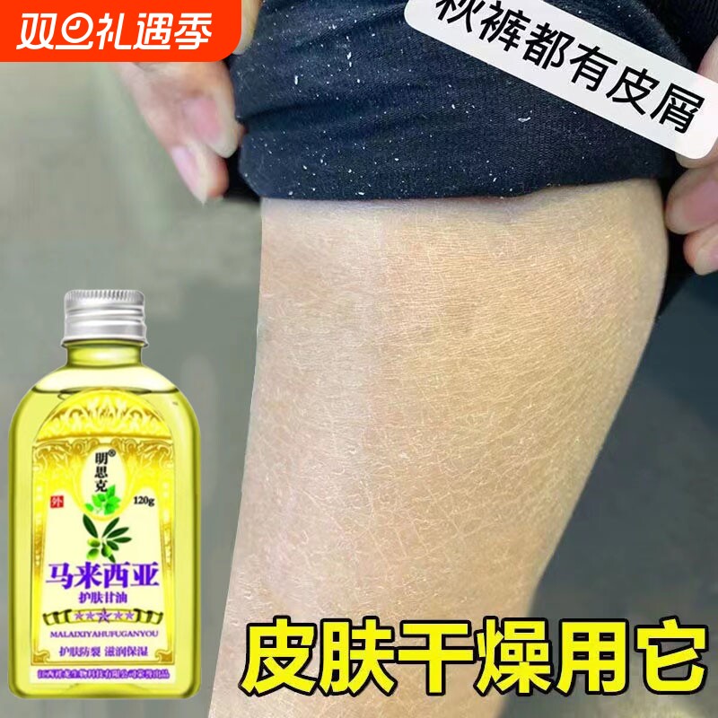 小腿干燥起皮鱼鳞皮肤霜秋冬皮肤干痒儿童护肤甘油身体润肤油止痒