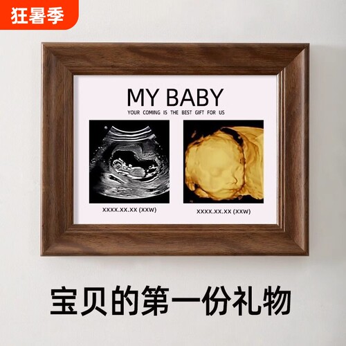 四维照片相框孕期胎儿ntB超彩超