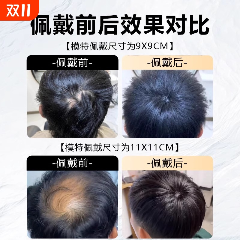 脱发后脑勺假发片头顶补发片男士发头旋发缝遮盖稀少女士模特真人