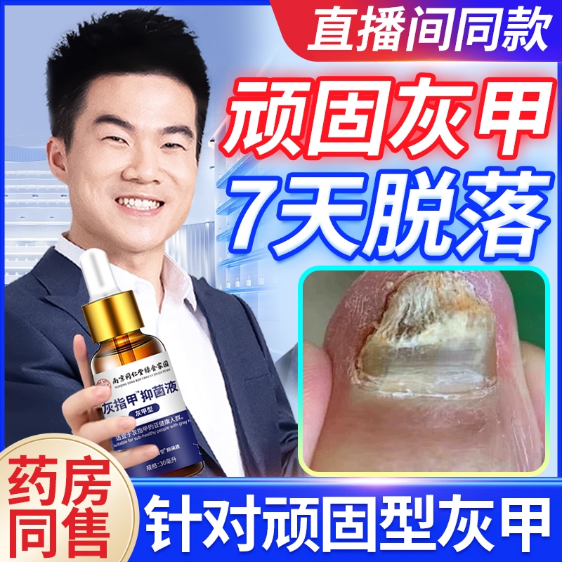 灰指甲脱甲脚趾部位型足部护理正品抑菌加快亮新甲生长修复凝胶