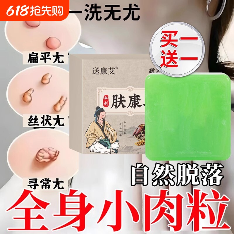 脖子上长祛去尤疣瘊小肉粒草本肤康皂专用克尤皂手工药香皂旗舰店