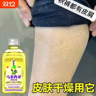 小腿干燥起皮鱼鳞皮肤霜秋冬皮肤干痒儿童护肤甘油身体润肤油止痒