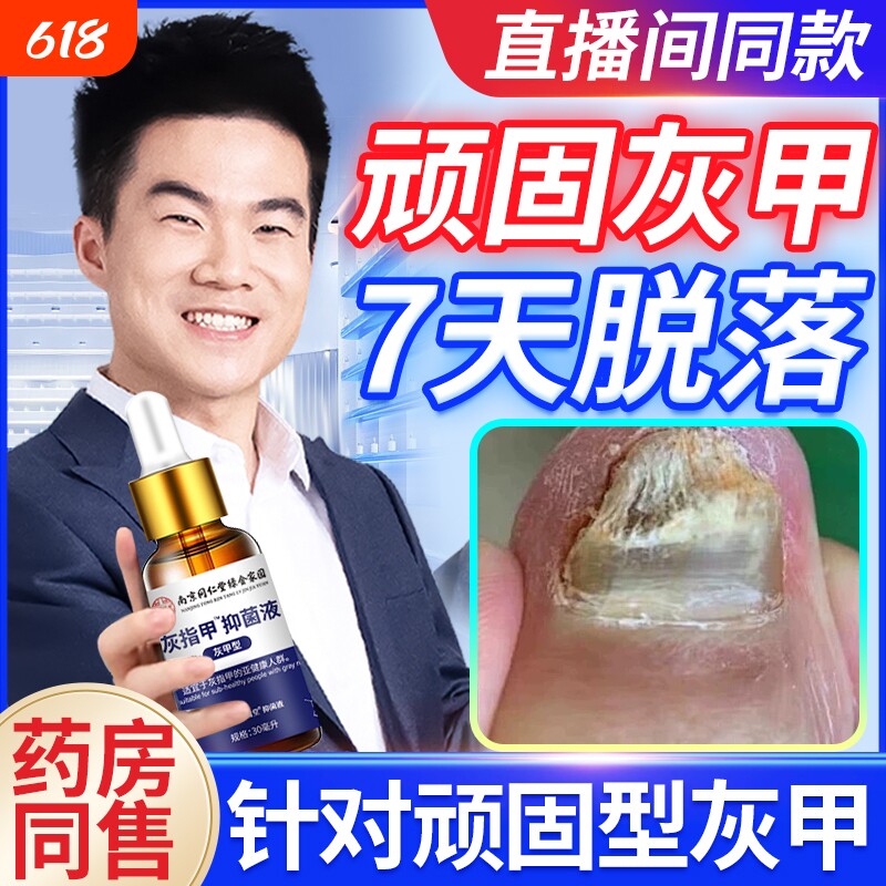 灰指甲脱甲脚趾型足部正品抑菌加快亮新甲生长修复凝胶药水增厚