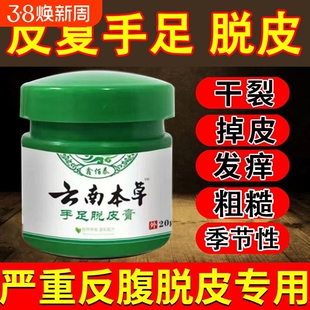 云南本草手足脱皮膏手指上起皮干燥儿童掉皮专用抑菌修复手部足部