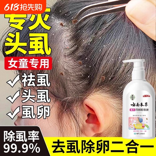 虱子药小女孩头发去除虱卵除儿童小孩头上去虱子的洗发水虫卵双杀