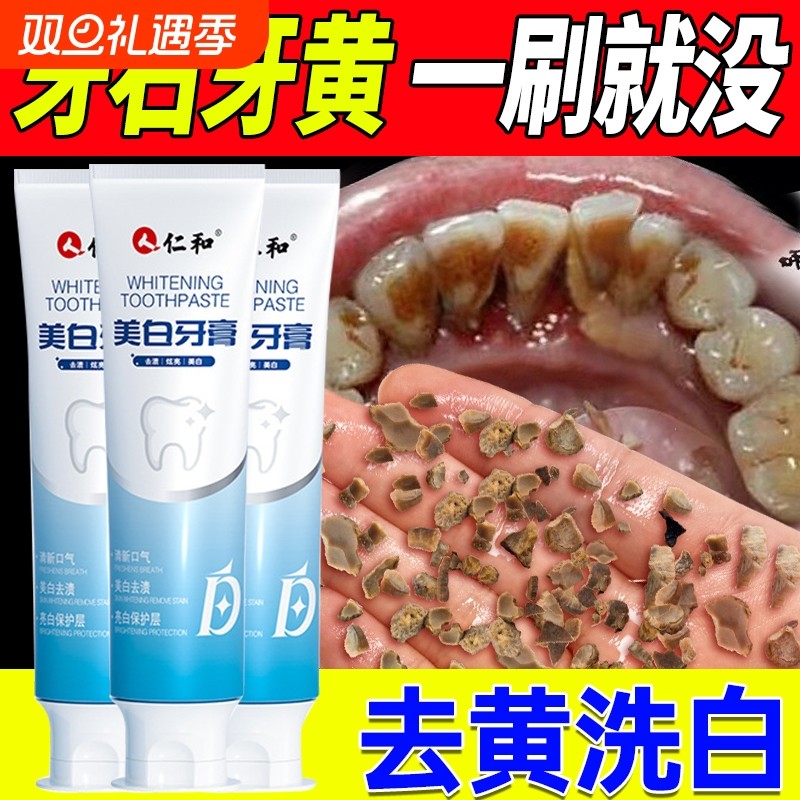 牙膏美白去黄口臭牙结石成人洗白神器官方正品男女士专用旗舰店