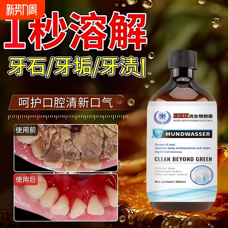 【爆款断货王】牙石溶解漱口水洗牙齿污垢牙垢黄牙渍清理神器正品