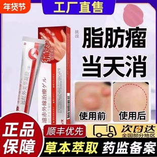 去除皮下脂肪瘤消瘤膏特葆肿硬块皮肤纤维元官方旗舰店医生制药T3