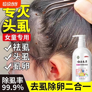 虱子药小女孩头发去除虱卵除儿童小孩头上去虱子的洗发水虫卵双杀