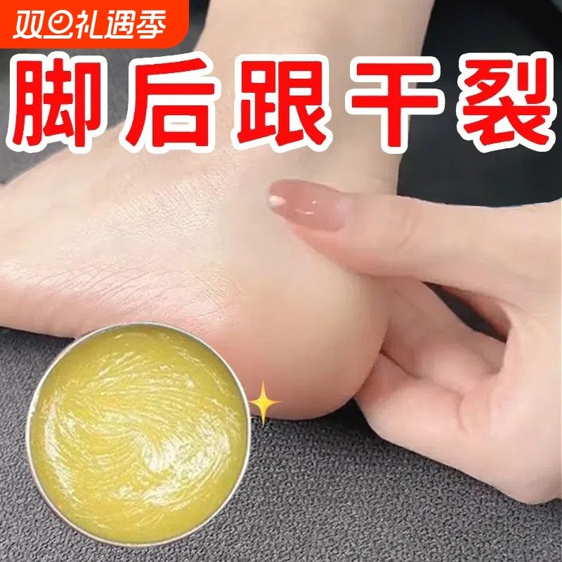 手足脚后跟干裂足霜手脱皮起皮滋润补水护手霜开裂干燥硬皮脚跟
