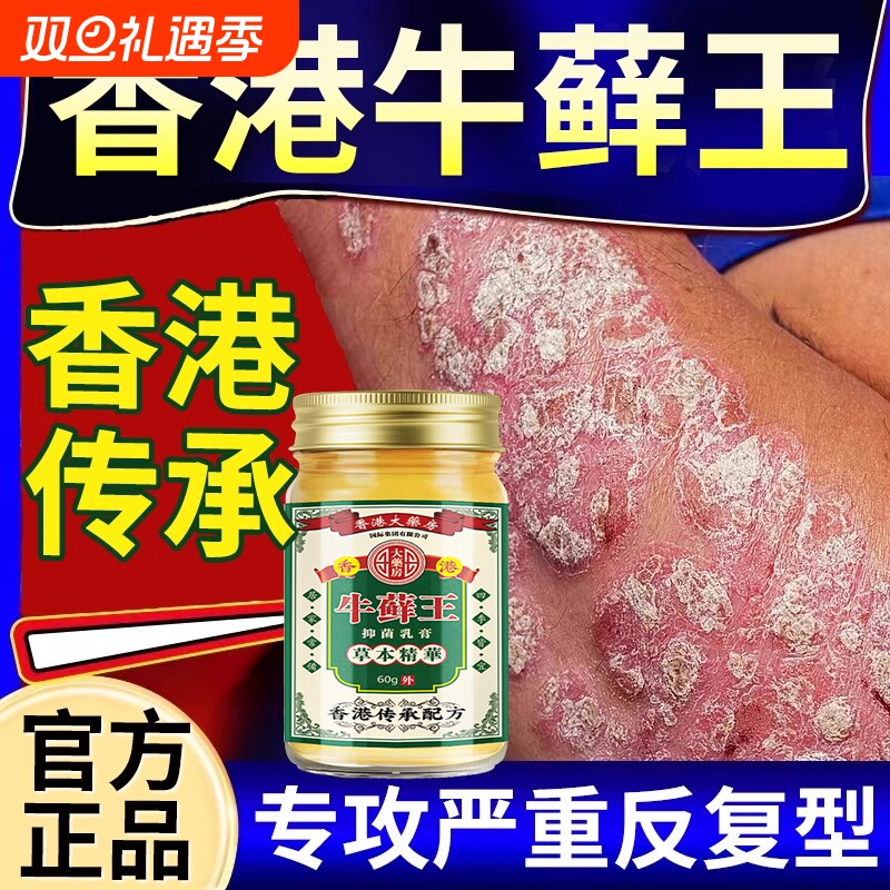 止痒王正品顽固性皮肤瘙痒快速止抑菌痒全身过敏外用牛止痒皮膏藓