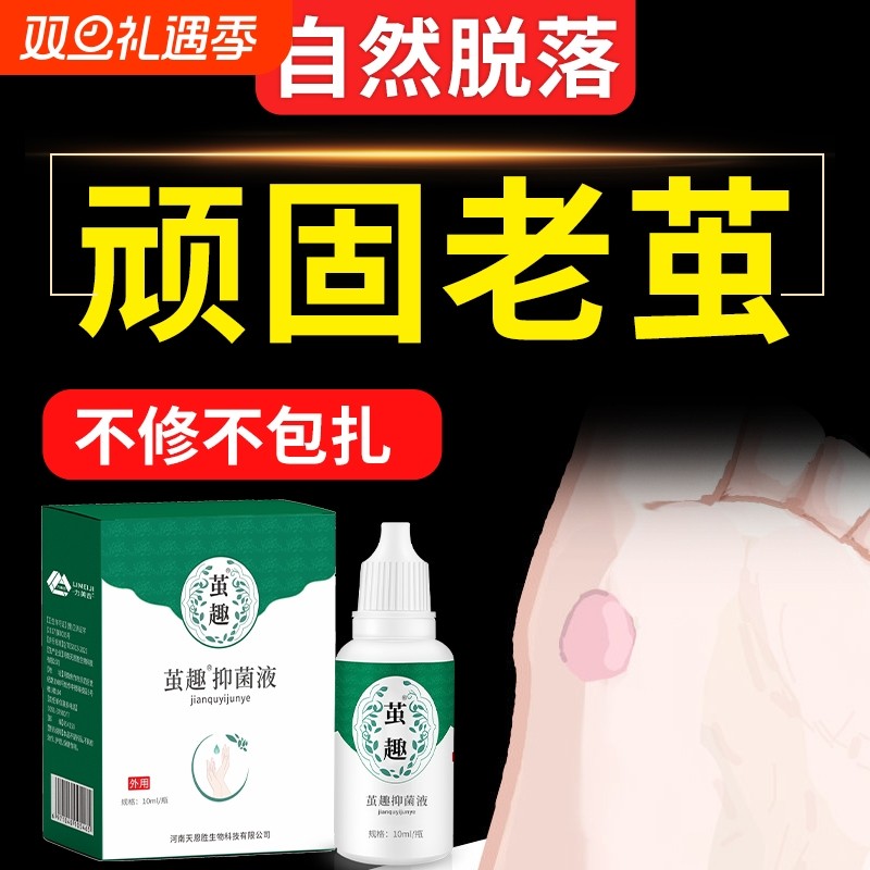 清茧灵脚底老茧去除软化剂茧净立茧死皮硬皮脚垫神器角质泡脚草本