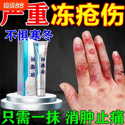 冻疮防冻伤药防冻裂红肿成人儿童手足耳朵脸部消肿修复冻疮神器