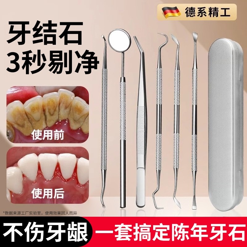 牙结石去除器牙齿清洁口腔镜子剔牙神器去污垢工具专用洁牙科家用