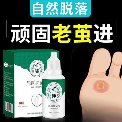专攻老茧鸡茧【自然脱落】软化剂