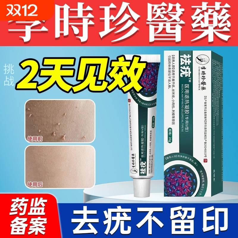 疣瘊肉粒一抹无忧疣体脱落药膏去尤扁平疣去疣一抹灵点疣软膏修复