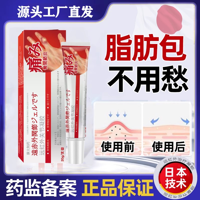 皮下脂肪肿块纤维皮肤脂肪瘤手指肿胀变形去除膏药贴膏官方旗舰店